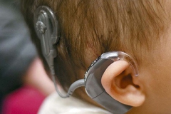 COCHLEARIMPLANT
